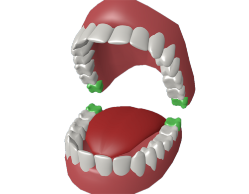 Как долго заживает десна после удаления зуба?